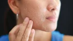 Dry Skin Combo - Image 2