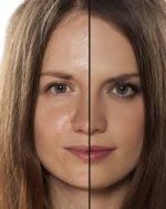 Oily Skin Combo - Image 2